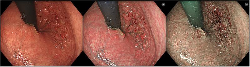 https://cdn.ncbi.nlm.nih.gov/pmc/blobs/ae0e/12061549/398852e6886a/DEO2-6-e70141-g002.jpg