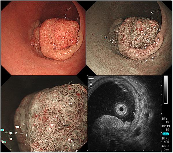 https://cdn.ncbi.nlm.nih.gov/pmc/blobs/ae0e/12061549/fc94094a7976/DEO2-6-e70141-g003.jpg