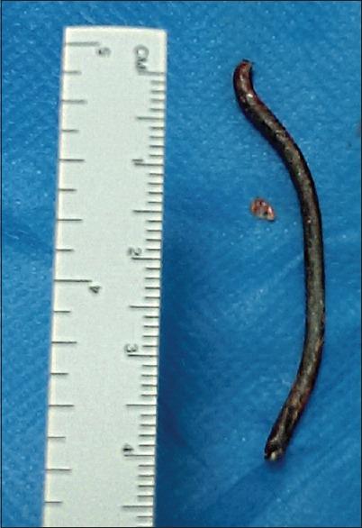 https://cdn.ncbi.nlm.nih.gov/pmc/blobs/ae0e/4849307/efaf9cb6eaab/AJNS-11-309a-g002.jpg