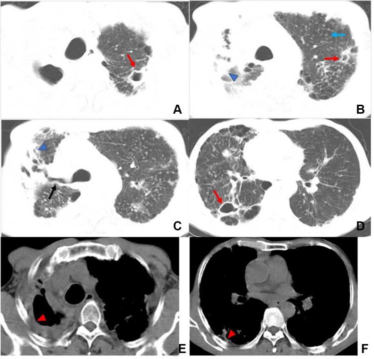 https://cdn.ncbi.nlm.nih.gov/pmc/blobs/ae0e/9897068/eb29c841ed15/IDR-16-651-g0002.jpg