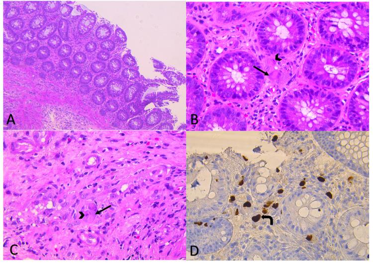 https://cdn.ncbi.nlm.nih.gov/pmc/blobs/ae15/8942289/0975e46ac470/cureus-0014-00000022455-i01.jpg