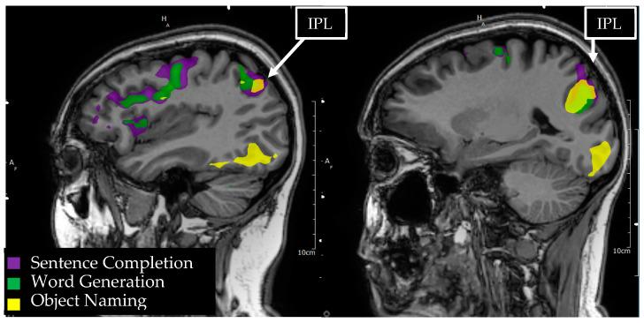 https://cdn.ncbi.nlm.nih.gov/pmc/blobs/ae1d/10366753/0bdf210726b0/tomography-09-00100-g005.jpg