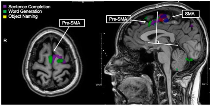 https://cdn.ncbi.nlm.nih.gov/pmc/blobs/ae1d/10366753/96260afcbe1f/tomography-09-00100-g004.jpg