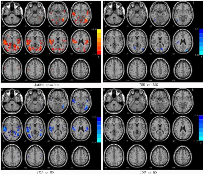 https://cdn.ncbi.nlm.nih.gov/pmc/blobs/ae1d/3732240/2597f189cab0/pone.0071368.g002.jpg