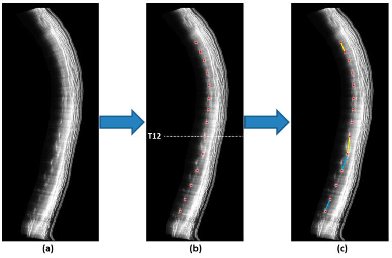https://cdn.ncbi.nlm.nih.gov/pmc/blobs/ae1e/10253971/b44778a036b2/jcm-12-03854-g002.jpg