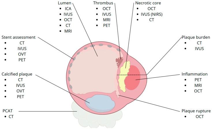 https://cdn.ncbi.nlm.nih.gov/pmc/blobs/ae1e/12293362/5f5e80564ccf/diagnostics-15-01822-g003.jpg