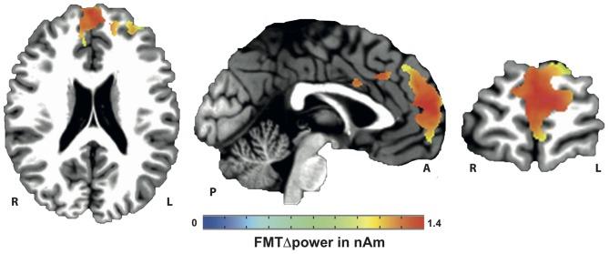 https://cdn.ncbi.nlm.nih.gov/pmc/blobs/ae1f/4858529/0f926f7b9f87/fncel-10-00120-g0004.jpg