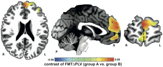 https://cdn.ncbi.nlm.nih.gov/pmc/blobs/ae1f/4858529/0fd08ffaf9fa/fncel-10-00120-g0002.jpg