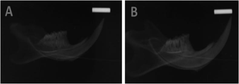 https://cdn.ncbi.nlm.nih.gov/pmc/blobs/ae3a/6395371/f2f5e9597649/gr4.jpg