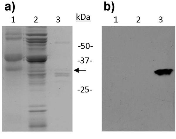https://cdn.ncbi.nlm.nih.gov/pmc/blobs/ae3c/2836272/c0feafda47fd/1471-2091-11-11-5.jpg
