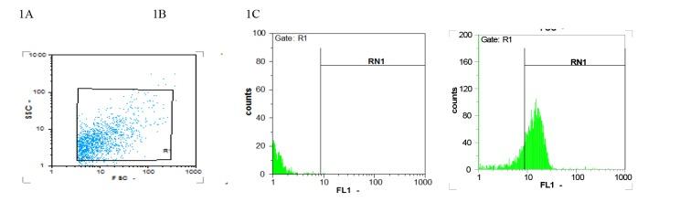 https://cdn.ncbi.nlm.nih.gov/pmc/blobs/ae41/6708106/82cf8d1205da/mjiri-33-55-g001.jpg