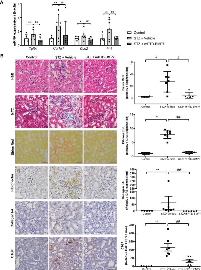https://cdn.ncbi.nlm.nih.gov/pmc/blobs/ae43/10244744/9e07df2d3d8a/fendo-14-1172199-g004.jpg