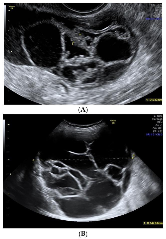 https://cdn.ncbi.nlm.nih.gov/pmc/blobs/ae53/10341072/4de5d981292f/diagnostics-13-02152-g005.jpg
