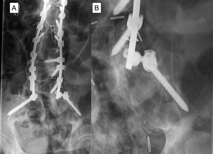 https://cdn.ncbi.nlm.nih.gov/pmc/blobs/ae56/10642569/4fbc7c325d5c/CEOR-15-765-g0004.jpg
