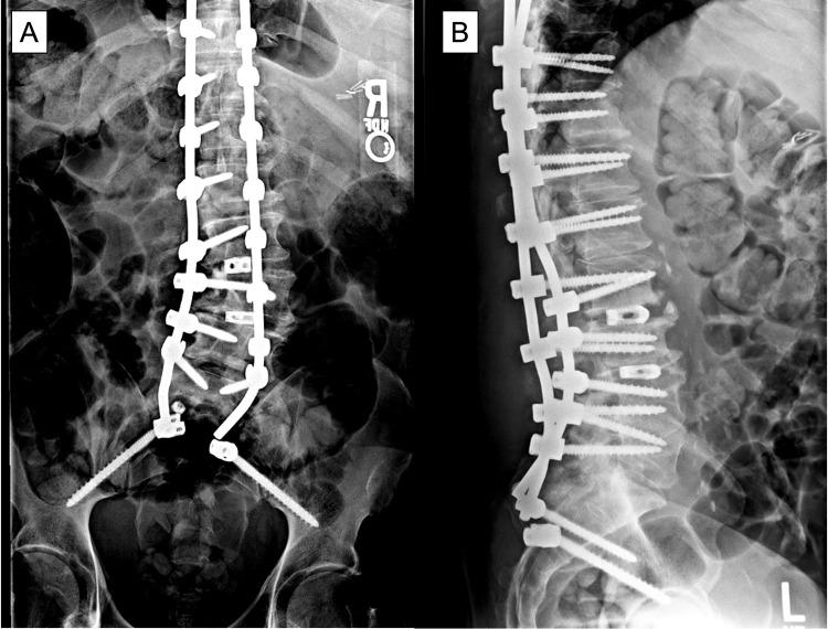 https://cdn.ncbi.nlm.nih.gov/pmc/blobs/ae56/10642569/98efda173d27/CEOR-15-765-g0001.jpg