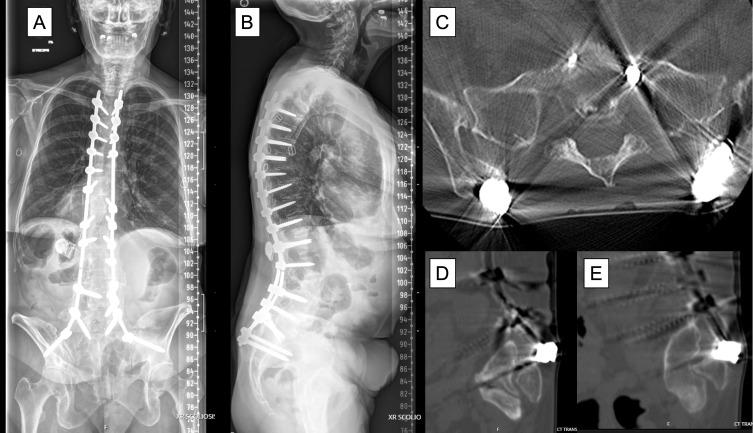 https://cdn.ncbi.nlm.nih.gov/pmc/blobs/ae56/10642569/cbebfe122bec/CEOR-15-765-g0003.jpg