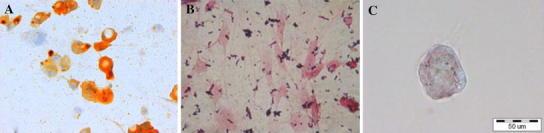 https://cdn.ncbi.nlm.nih.gov/pmc/blobs/ae5f/3898129/2f43acda1873/5_2013_249_Fig1_HTML.jpg