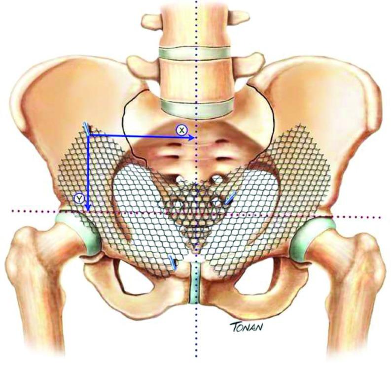 https://cdn.ncbi.nlm.nih.gov/pmc/blobs/ae5f/5592431/e474642a7161/jls0201636450001.jpg