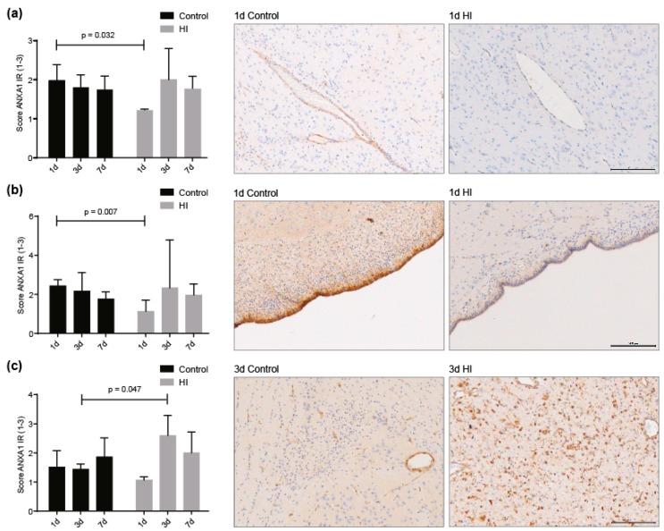 https://cdn.ncbi.nlm.nih.gov/pmc/blobs/ae65/6406389/cd15b8cfac47/jcm-08-00137-g005.jpg