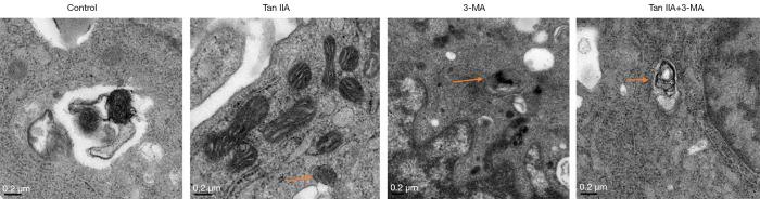 https://cdn.ncbi.nlm.nih.gov/pmc/blobs/ae68/8797932/8efa3cd8d5bc/tcr-09-11-6919-f2.jpg