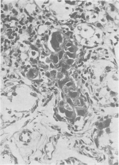 https://cdn.ncbi.nlm.nih.gov/pmc/blobs/ae69/1988476/8651defd6180/archdisch01423-0118-b.jpg