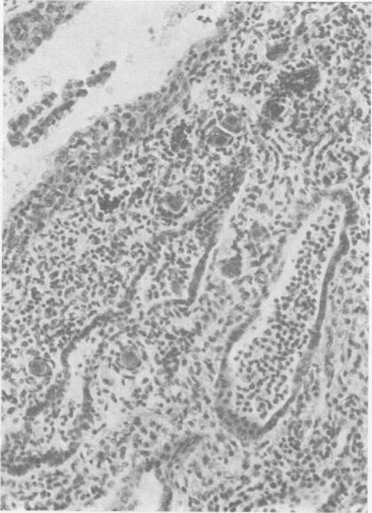 https://cdn.ncbi.nlm.nih.gov/pmc/blobs/ae69/1988476/a9ca33804b94/archdisch01423-0118-d.jpg