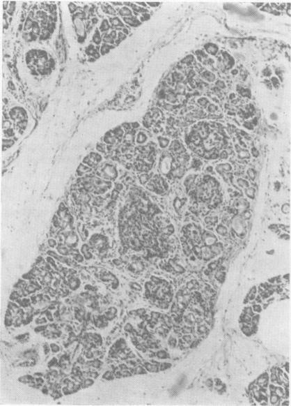 https://cdn.ncbi.nlm.nih.gov/pmc/blobs/ae69/1988476/b0577ab0e901/archdisch01423-0118-c.jpg