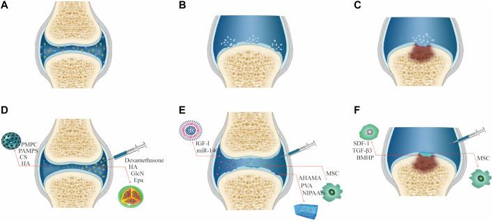 https://cdn.ncbi.nlm.nih.gov/pmc/blobs/ae69/9207401/5227ea823881/fbioe-10-858656-g002.jpg