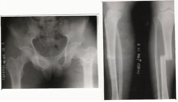 https://cdn.ncbi.nlm.nih.gov/pmc/blobs/ae6e/2241764/d167b8366d8a/1752-2897-1-2-3.jpg