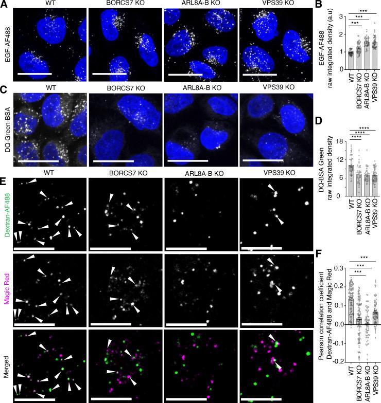 https://cdn.ncbi.nlm.nih.gov/pmc/blobs/ae6f/10202829/214e8e1de3c9/JCB_202209084_Fig6.jpg