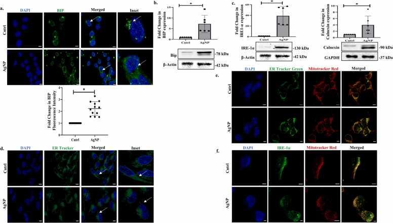 https://cdn.ncbi.nlm.nih.gov/pmc/blobs/ae73/9742960/5383c0bf957a/gr3.jpg