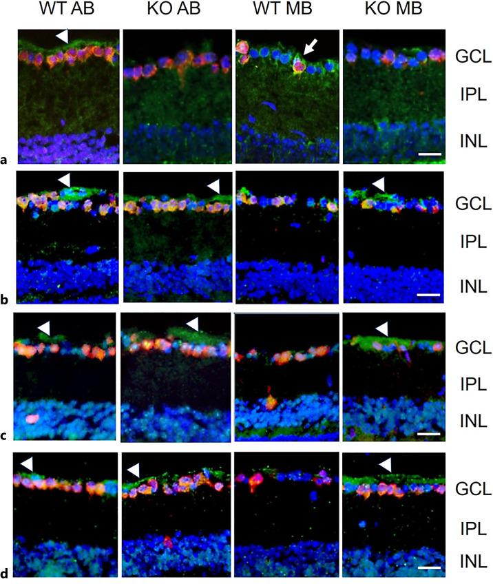 https://cdn.ncbi.nlm.nih.gov/pmc/blobs/ae77/10614569/2bf9a79126d2/ore-2023-0066-0001-533497_F03.jpg