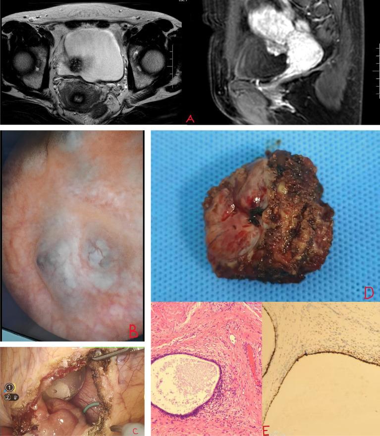 https://cdn.ncbi.nlm.nih.gov/pmc/blobs/ae7e/12074918/5706639c3cbf/fmed-12-1573513-g001.jpg