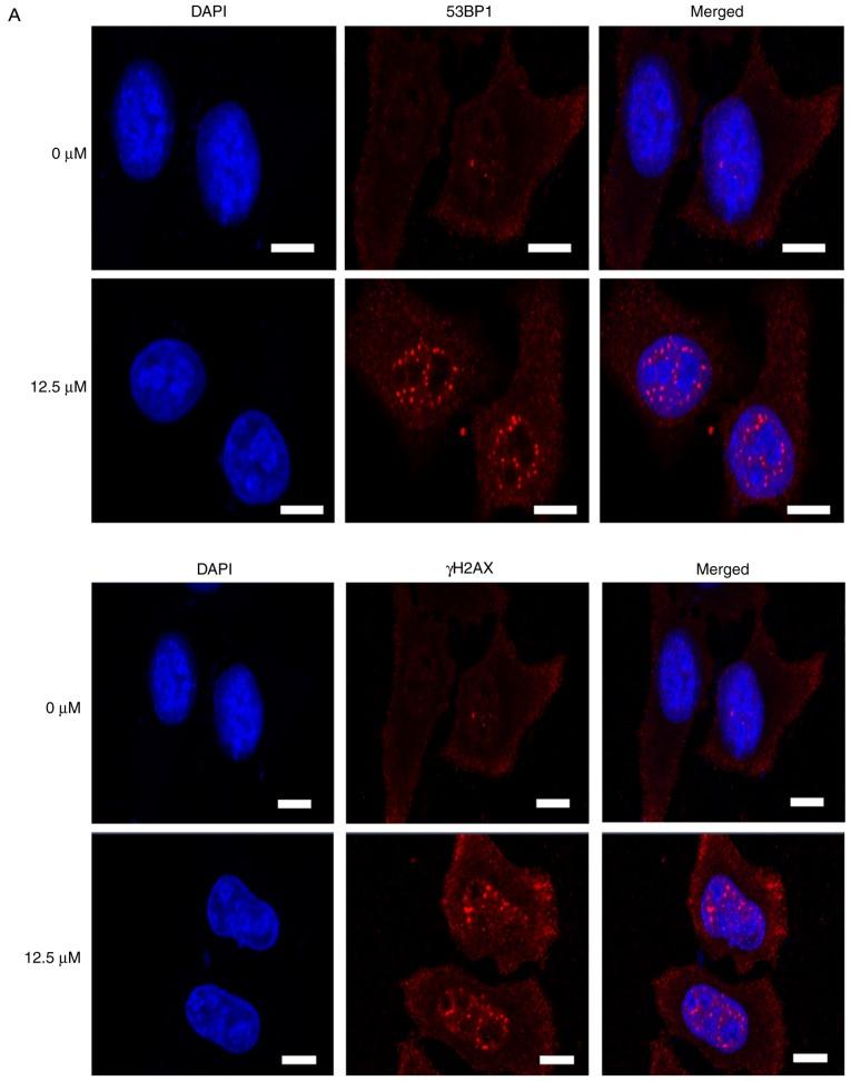 https://cdn.ncbi.nlm.nih.gov/pmc/blobs/ae86/6312933/734cd97241b3/OR-41-02-0765-g04.jpg