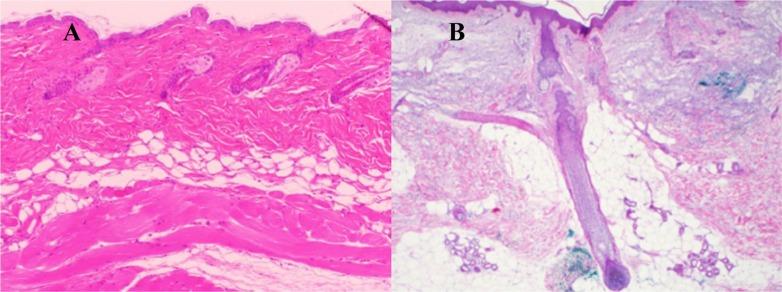 https://cdn.ncbi.nlm.nih.gov/pmc/blobs/ae88/4993342/238f4fd58794/aging-08-1457-g001.jpg