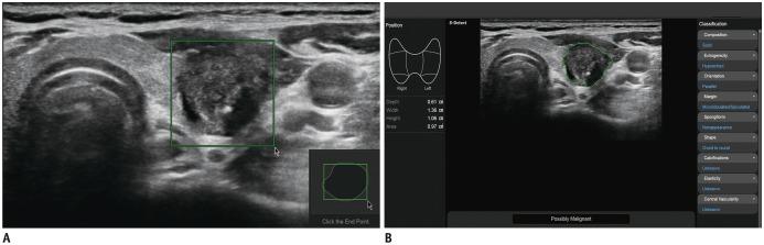 https://cdn.ncbi.nlm.nih.gov/pmc/blobs/ae8a/6005935/765652ed97bf/kjr-19-665-g001.jpg