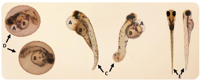 https://cdn.ncbi.nlm.nih.gov/pmc/blobs/ae8f/7996764/e1c16a344c04/toxics-09-00044-g003.jpg