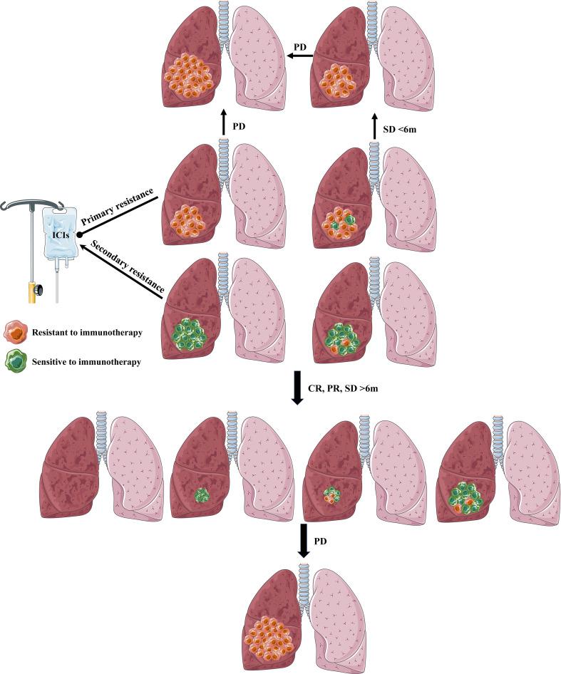 https://cdn.ncbi.nlm.nih.gov/pmc/blobs/ae90/10115980/2e7b30f85b22/fimmu-14-1129465-g003.jpg