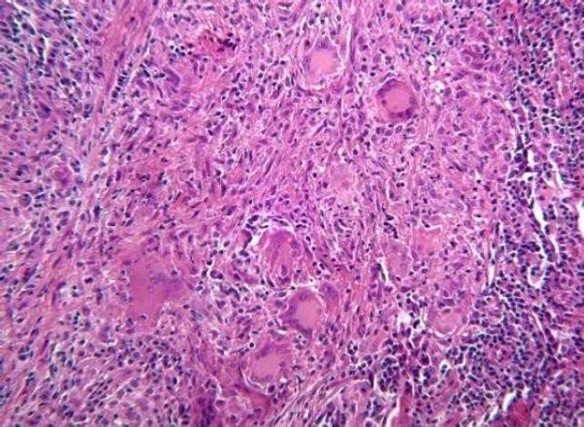 https://cdn.ncbi.nlm.nih.gov/pmc/blobs/ae98/3075451/1a1cfc6553e9/DRJ-6-47-g002.jpg
