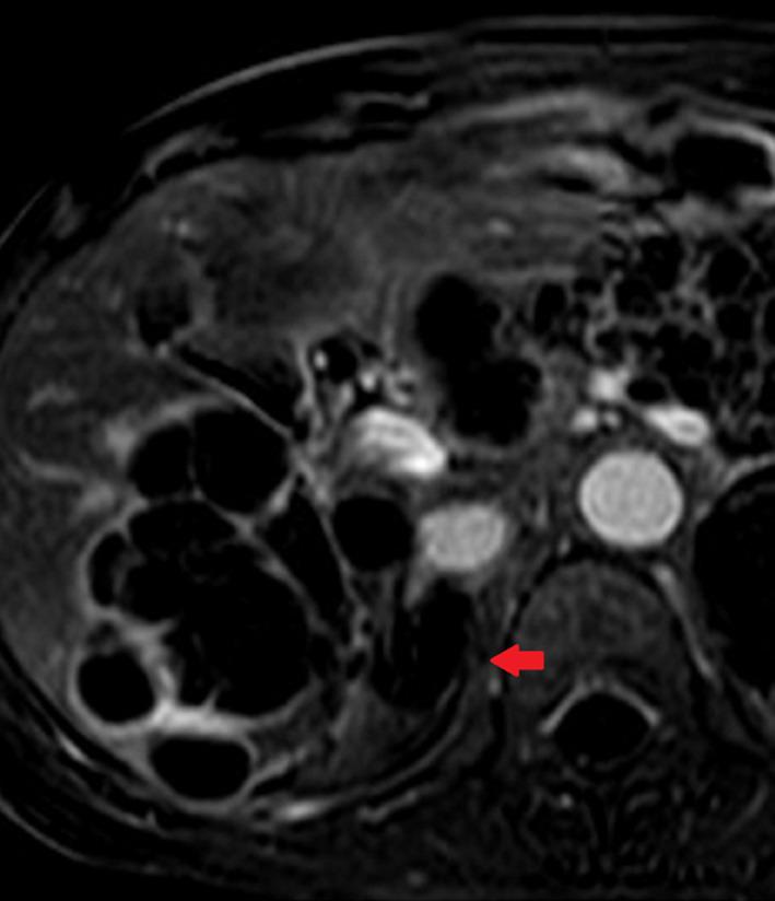https://cdn.ncbi.nlm.nih.gov/pmc/blobs/ae98/7981655/aa5de6c486a7/CCR3-9-1261-g005.jpg