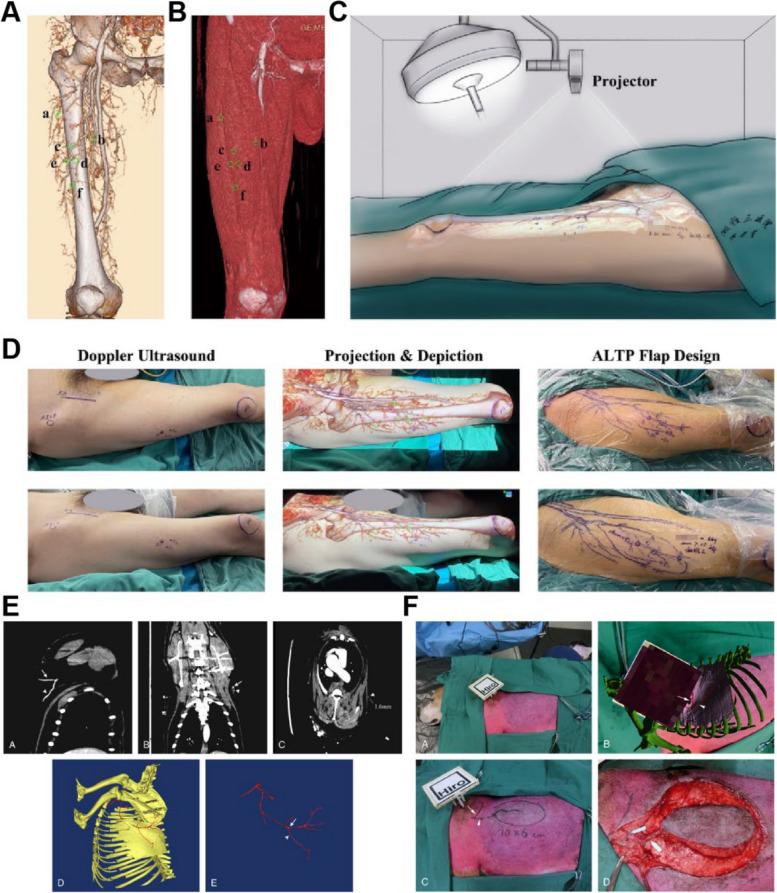 https://cdn.ncbi.nlm.nih.gov/pmc/blobs/ae99/11661318/2e3f01a1e0fd/12909_2024_6423_Fig2_HTML.jpg