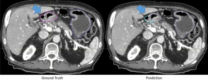 https://cdn.ncbi.nlm.nih.gov/pmc/blobs/ae9b/9646761/fd4d575bc942/41598_2022_21206_Fig5_HTML.jpg