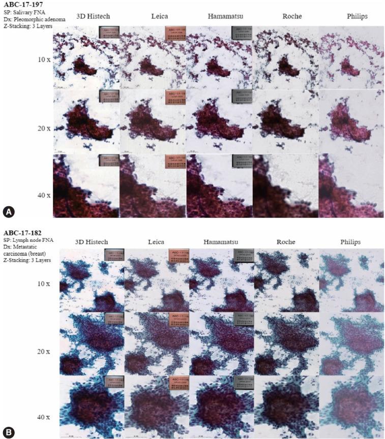 https://cdn.ncbi.nlm.nih.gov/pmc/blobs/ae9d/10518242/dd88ec4dac15/jptm-2023-07-17f6.jpg