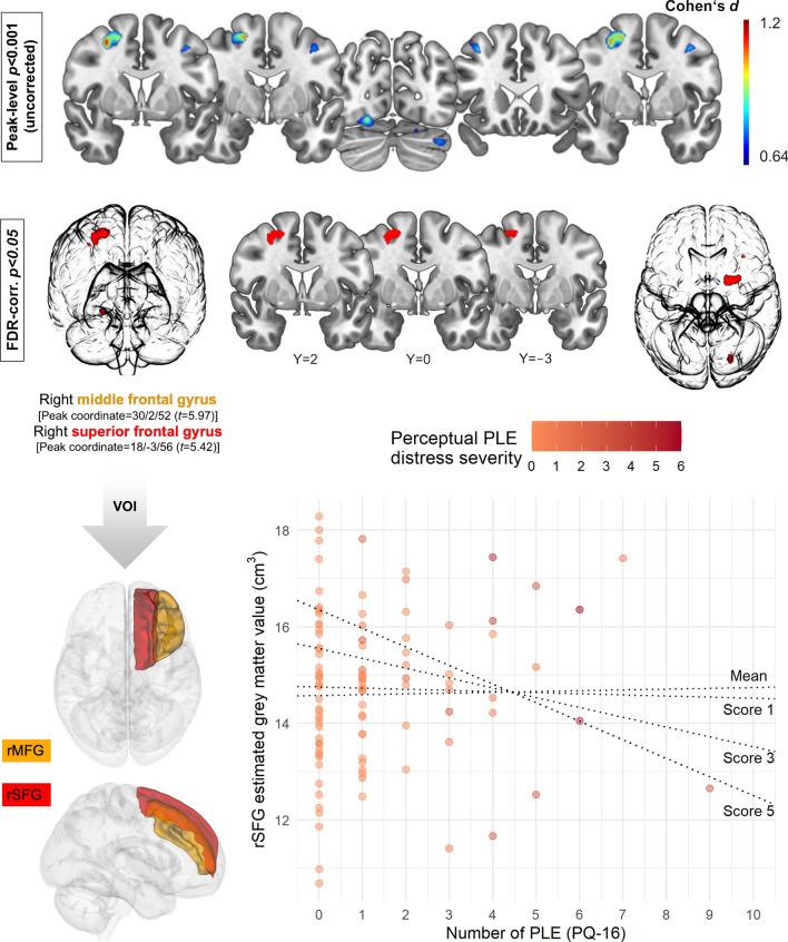 https://cdn.ncbi.nlm.nih.gov/pmc/blobs/aea1/8354976/caf3e1b21129/406_2020_1229_Fig2_HTML.jpg
