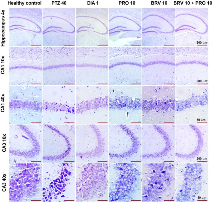 https://cdn.ncbi.nlm.nih.gov/pmc/blobs/aea6/11520030/a272faadbcd7/CNS-30-e70078-g003.jpg