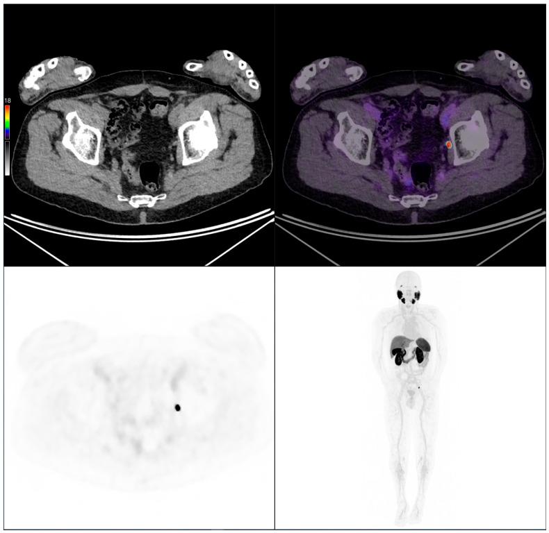 https://cdn.ncbi.nlm.nih.gov/pmc/blobs/aea6/12249072/ecf4b6390586/cancers-17-02249-g007.jpg