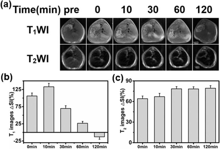 https://cdn.ncbi.nlm.nih.gov/pmc/blobs/aeaa/6817351/4169b0631cbb/IJN-14-8499-g0004.jpg