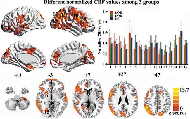 https://cdn.ncbi.nlm.nih.gov/pmc/blobs/aeab/5652699/0ad52785560f/oncotarget-08-76214-g001.jpg