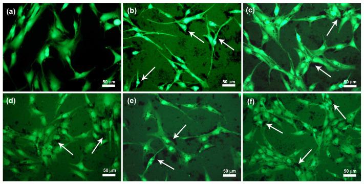https://cdn.ncbi.nlm.nih.gov/pmc/blobs/aeab/9181356/9657da2994e9/ijms-23-06278-g010.jpg