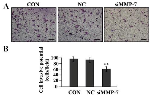 https://cdn.ncbi.nlm.nih.gov/pmc/blobs/aeb0/3980206/2f286dca0d05/ejh-2014-1-2262-g006.jpg